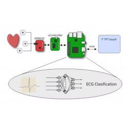Fabrication of a low-cost ECG pathology detection device